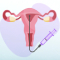IUI