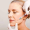 Botox Therapy