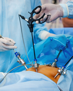  Laparoscopy for fallopian tube assessment, ovarian drilling, and pelvic infection treatment 