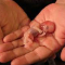 Miscarriages