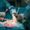 Radical surgery
