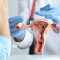 Tubal ligation 